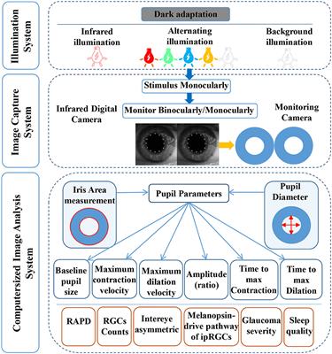 Evaluating State-of-the-Art Computerized Pupillary Assessments for Glaucoma Detection: A Systematic Review and Meta-Analysis